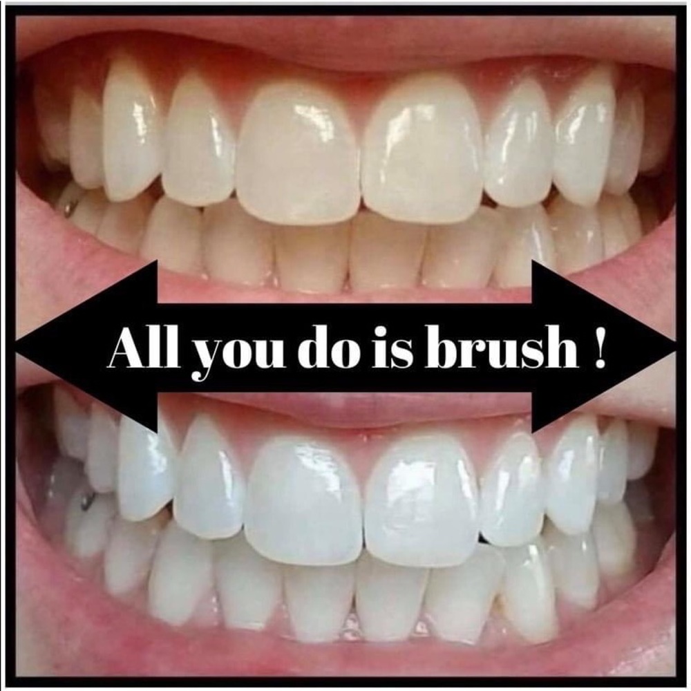 Whitening Toothpaste - Picture 2 of 6